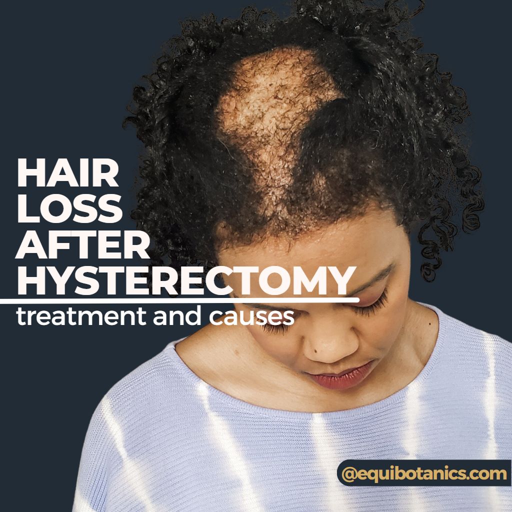 hair-loss-after-hysterectomy-treatment-and-causes-equi-botanics