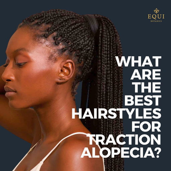 What are the Best Hairstyles for Traction Alopecia? – Equi Botanics